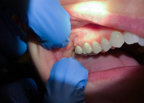 Best 24-Hour Emergency Dentist in Mitchellville, IA